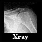 Normal Xrays