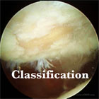 chondromalacia patella