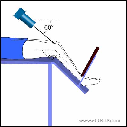 merchant view technique