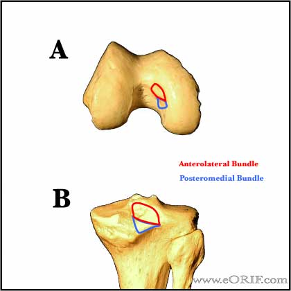 pcl anatomy image