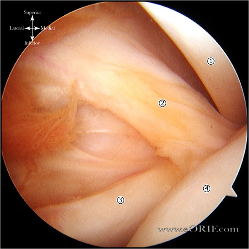 superior glenohumeral ligament