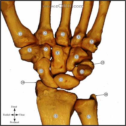 carpal bones picture