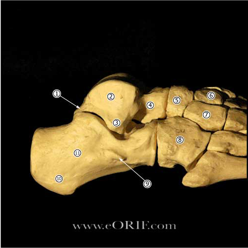 talus lateral 